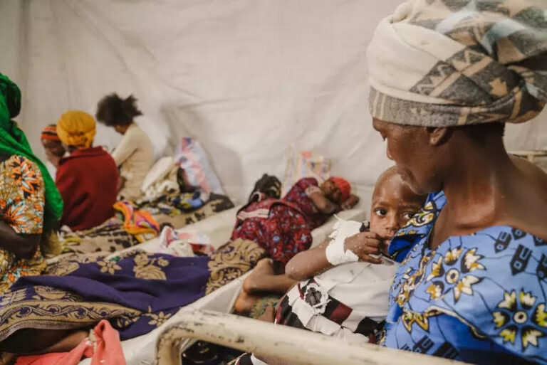 RDC – SANTÉ : Les enfants supportent le fardeau de l’épidémie de Mpox